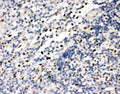 Anti-FLI1 antibody, PA2179, IHC(P)
IHC(P): Human Tonsil Tissue