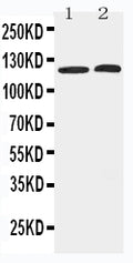 Anti-HDAC5 antibody, PA2180, Western blotting
Lane 1: HELA Cell Lysate
Lane 2: COLO320 Cell Lysate