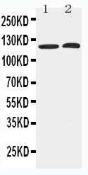 Anti-HDAC5 antibody, PA2180, Western blotting
Lane 1: HELA Cell Lysate
Lane 2: COLO320 Cell Lysate