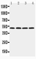 Anti-HYAL1 antibody, PA2181-2, Western blotting
Lane 1: NRK Cell Lysate
Lane 2: Mouse Liver Tissue Lysate
Lane 3: Mouse Kidney Tissue Lysate
Lane 4: SP2/0 Cell Lysate