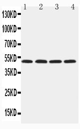 Anti-HYAL1 antibody, PA2181-2, Western blotting
Lane 1: NRK Cell Lysate
Lane 2: Mouse Liver Tissue Lysate
Lane 3: Mouse Kidney Tissue Lysate
Lane 4: SP2/0 Cell Lysate