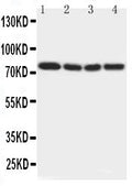 Anti-IRAK antibody, PA2183, Western blotting
Lane 1: Rat Liver Tissue Lysate
Lane 2: Human Placenta Tissue Lysate
Lane 3: MCF-7 Cell Lysate
Lane 4: PANC Cell Lysate