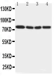 Anti-IRAK antibody, PA2183, Western blotting
Lane 1: Rat Liver Tissue Lysate
Lane 2: Human Placenta Tissue Lysate
Lane 3: MCF-7 Cell Lysate
Lane 4: PANC Cell Lysate
