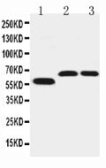 Anti-SLC1A4 antibody, PA2186, Western blotting
Lane 1: U87 Cell Lysate
Lane 2: Rat Brain Tissue Lysate
Lane 3: Mouse Brain Tissue Lysate