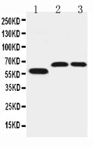 Anti-SLC1A4 antibody, PA2186, Western blotting
Lane 1: U87 Cell Lysate
Lane 2: Rat Brain Tissue Lysate
Lane 3: Mouse Brain Tissue Lysate