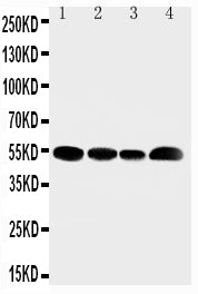 Anti-SLC16A4 antibody, PA2189, Western blotting
Lane 1: Rat Testis Tissue Lysate
Lane 2: JURKAT Cell Lysate
Lane 3: HELA Cell Lysate
Lane 4: MCF-7 Cell Lysate