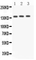 Anti-ACE antibody, PA2196-2, Western blotting
All lanes: Anti ACE (PA2196-2) at 0.5ug/ml
Lane 1: A549 Whole Cell Lysate at 40ug
Lane 2: HELA Whole Cell Lysate at 40ug
Lane 3: 22RV1 Whole Cell Lysate at 40ug
Predicted bind size: 150KD
Observed bind size: 150KD