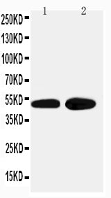 Anti-alpha 2a Adrenergic Receptor antibody, PA2197, Western blotting
Lane 1: HELA Cell Lysate
Lane 2: PANC Cell Lysate