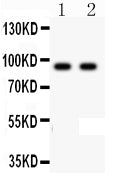 Anti-CDH17 antibody, PA2200, Western blotting
All lanes: Anti CDH17(PA2200) at 0.5ug/ml
Lane 1: HELA Whole Cell Lysate at 40ug
Lane 2: SW620 Whole Cell Lysate at 40ug
Predicted bind size: 92KD
Observed bind size: 92KD