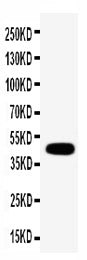 Anti-Connexin 45/GJA7 antibody, PA2206, Western blotting
WB: MCF-7 Cell Lysate