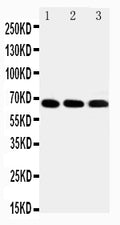Anti-IRAKM antibody, PA2207-1, Western blotting
Lane 1: HELA Cell Lysate
Lane 2: JURKAT Cell Lysate
Lane 3: HUT102 Cell Lysate
