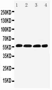 Anti-IRF5 antibody, PA2208, Western blotting
Lane 1: Human Placenta Tissue Lysate
Lane 2: Rat Thymus Tissue Lysate
Lane 3: Rat Kidney Tissue Lysate
Lane 4: Rat Ovary Tissue Lysate