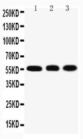 Anti-KLF4 antibody, PA2211, Western blotting
Lane 1: HELA Cell Lysate
Lane 2: A549 Cell Lysate
Lane 3: U20S Cell Lysate