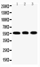 Anti-KLF4 antibody, PA2211, Western blotting
Lane 1: HELA Cell Lysate
Lane 2: A549 Cell Lysate
Lane 3: U20S Cell Lysate