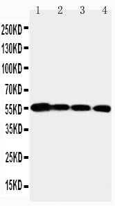 Anti-MMP24 antibody, PA2212, Western blotting
Lane 1: PANC Cell Lysate
Lane 2: HELA Cell Lysate
Lane 3: SMMC Cell Lysate
Lane 4: A549 Cell Lysate