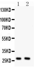 Anti-OLIG1 antibody, PA2213, Western blotting
All lanes: Anti OLIG1 (PA2213) at 0.5ug/ml
Lane 1: U87 Whole Cell Lysate at 40ug
Lane 2: HELA Whole Cell Lysate at 40ug
Predicted bind size: 28KD
Observed bind size: 28KD