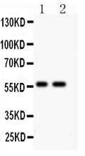 Anti-PIAS4 antibody, PA2215, Western blotting
All lanes: Anti PIAS4 (PA2215) at 0.5ug/ml
Lane 1: Human Placenta Tissue Lysate at 50ug
Lane 2: A431 Whole Cell Lysate at 40ug
Predicted bind size: 57KD
Observed bind size: 57KD