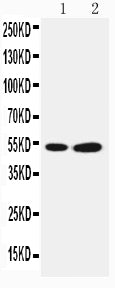 Anti-SBP/SELENBP1 antibody, PA2216, Western blotting
Lane 1: COLO320 Cell Lysate
Lane 2: PANC Cell Lysate