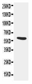 Anti-AACT/SERPINA3 Antibody Picoband®