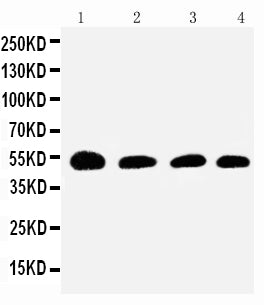 Anti-Antithrombin III antibody, PA2218, Western blotting
Lane 1: Rat Testis Tissue Lysate
Lane 2: SMMC Cell Lysate
Lane 3: JURKAT Cell Lysate
Lane 4: RAJI Cell Lysate