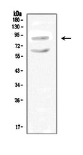 Anti-Sodium/hydrogen exchanger 2 SLC9A2 Antibody Picoband®
