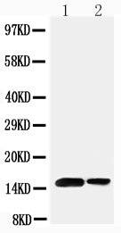 Anti-Sumo 1 antibody, PA2220, Western blotting
Lane 1: Rat Spleen Tissue Lysate
Lane 2: Human Placenta Tissue Lysate