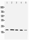 Anti-Diubiquitin antibody, PA2222, Western blotting
Lane 1: HELA Cell Lysate
Lane 2: SKOV Cell Lysate
Lane 3: MCF-7 Cell Lysate
Lane 4: A549 Cell Lysate
Lane 5: SMMC Cell Lysate