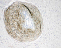 Anti-Calponin/CNN1 Antibody Picoband®