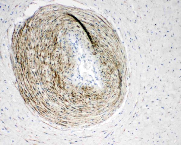 Anti-Calponin/CNN1 Antibody Picoband®