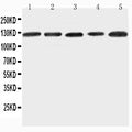 Anti-ITGA7 antibody, PA2226, Western blotting
Lane 1: 293T Cell Lysate
Lane 2: A431 Cell Lysate
Lane 3: HELA Cell Lysate
Lane 4: JURKAT Cell Lysate
Lane 5: RAJI Cell Lysate