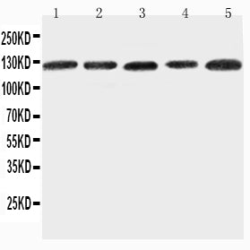 Anti-ITGA7 antibody, PA2226, Western blotting
Lane 1: 293T Cell Lysate
Lane 2: A431 Cell Lysate
Lane 3: HELA Cell Lysate
Lane 4: JURKAT Cell Lysate
Lane 5: RAJI Cell Lysate