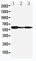 Anti-G-protein coupled receptor 30 antibody, PA2235, Western blotting
Lane 1: COLO320 Cell Lysate
Lane 2: MCF-7 Cell Lysate
Lane 3: COS7 Cell Lysate