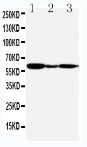 Anti-G-protein coupled receptor 30 antibody, PA2235, Western blotting
Lane 1: COLO320 Cell Lysate
Lane 2: MCF-7 Cell Lysate
Lane 3: COS7 Cell Lysate