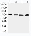 Anti-IRAK2 antibody, PA2236, Western blotting
Lane 1: 22RV Cell Lysate
Lane 2: A549 Cell Lysate
Lane 3: PANC Cell Lysate
Lane 4: SMMC Cell Lysate