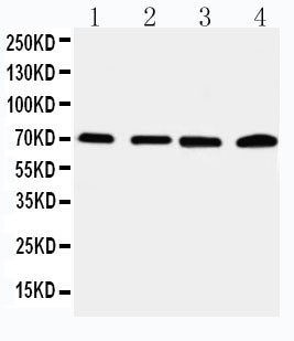 Anti-IRAK2 antibody, PA2236, Western blotting
Lane 1: 22RV Cell Lysate
Lane 2: A549 Cell Lysate
Lane 3: PANC Cell Lysate
Lane 4: SMMC Cell Lysate
