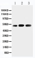 Anti-KIN antibody, PA2238, Western blotting
Lane 1: Rat Skeletal Muscle Tissue Lysate
Lane 2: Human Placenta Tissue Lysate
Lane 3: Rat Testis Tissue Lysate