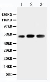 Anti-KIN antibody, PA2238, Western blotting
Lane 1: Rat Skeletal Muscle Tissue Lysate
Lane 2: Human Placenta Tissue Lysate
Lane 3: Rat Testis Tissue Lysate