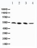 Anti-RIP3/RIPK3 Antibody Picoband®