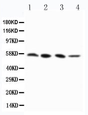 Anti-RIP3/RIPK3 Antibody Picoband®
