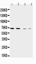 Anti-CAT1 antibody, PA2245, Western blotting
Lane 1: Human Placenta Tissue Lysate
Lane 2: HELA Cell Lysate
Lane 3: SKOV-3 Cell Lysate
Lane 4: HT1080 Cell Lysate