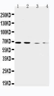 Anti-CAT1 antibody, PA2245, Western blotting
Lane 1: Human Placenta Tissue Lysate
Lane 2: HELA Cell Lysate
Lane 3: SKOV-3 Cell Lysate
Lane 4: HT1080 Cell Lysate