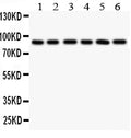 Anti-TLR1 antibody, PA2246, Western blotting
All lanes: Anti TLR1 (PA2246) at 0.5ug/ml
Lane 1: COLO320 Whole Cell Lysate at 40ug
Lane 2: SW620 Whole Cell Lysate at 40ug
Lane 3: SKOV Whole Cell Lysate at 40ug
Lane 4: JURKAT Whole Cell Lysate at 40ug
Lane 5: CEM Whole Cell Lysate at 40ug
Lane 6: PANC Whole Cell Lysate at 40ug
Predicted bind size: 90KD
Observed bind size: 90KD