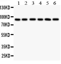 Anti-TLR1 antibody, PA2246, Western blotting
All lanes: Anti TLR1 (PA2246) at 0.5ug/ml
Lane 1: COLO320 Whole Cell Lysate at 40ug
Lane 2: SW620 Whole Cell Lysate at 40ug
Lane 3: SKOV Whole Cell Lysate at 40ug
Lane 4: JURKAT Whole Cell Lysate at 40ug
Lane 5: CEM Whole Cell Lysate at 40ug
Lane 6: PANC Whole Cell Lysate at 40ug
Predicted bind size: 90KD
Observed bind size: 90KD