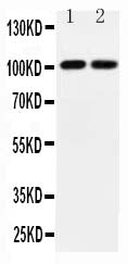 Anti-GRIA3 antibody, PA2249, All Western blotting
All lanes: Anti-GRIA3 (PA2249) at 0.5ug/ml

Lane 1: Rat Brain Tissue Lysate at 40ug

Lane 2: Mouse Brain Tissue Lysate at 40ug

Predicted bind size: 101KD

Observed bind size: 101KD