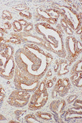 Anti-TNFAIP8L3 antibody, PA2257, IHC(P)
IHC(P): Human Intestinal Cancer Tissue
