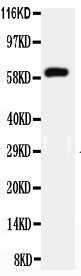 Anti-HNF1 beta antibody, PA2267, All Western blotting
All lanes: Anti-HNF1B(PA2267) at 0.5ug/ml

Lane 1: Mouse Liver Tissue Lysate at 40ug

Predicted bind size: 61KD

Observed bind size: 61KD