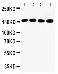 Anti-IRS1 antibody, PA2269, All Western blotting
All lanes: Anti-IRS1(PA2269) at 0.5ug/ml

Lane 1: HELA Whole Cell Lysate at 40ug

Lane 2: A549 Whole Cell Lysate at 40ug

Lane 3: 293T Whole Cell Lysate at 40ug

Lane 4: MCF-7 Whole Cell Lysate at 40ug

Predicted bind size: 132KD

Observed bind size: 132KD