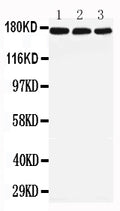 Anti-LRP5 antibody, PA2273, All Western blotting
All lanes: Anti-LRP5(PA2273) at 0.5ug/ml

Lane 1: Rat Liver Tissue Lysate at 40ug

Lane 2: Mouse Liver Tissue Lysate at 40ug

Lane 3: NIH Whole Cell Lysate at 40ug

Predicted bind size: 179KD

Observed bind size: 179KD