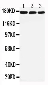 Anti-LRP5 antibody, PA2273, All Western blotting
All lanes: Anti-LRP5(PA2273) at 0.5ug/ml

Lane 1: Rat Liver Tissue Lysate at 40ug

Lane 2: Mouse Liver Tissue Lysate at 40ug

Lane 3: NIH Whole Cell Lysate at 40ug

Predicted bind size: 179KD

Observed bind size: 179KD