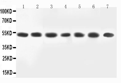 Anti-MEK2 antibody, PA2274, All Western blotting
All lanes: MAP2K2(PA2274) at 0.5ug/ml

Lane 1: Rat Skeletal Muscle Tissue Lysate at 40ug

Lane 2: Rat Kidney Tissue Lysate at 40ug

Lane 3: HELA Whole Cell Lysate at 40ug

Lane 4: COLO320 Whole Cell Lysate at 40ug

Lane 5: PC12 Whole Cell Lysate at 40ug

Lane 6: JURKAT Whole Cell Lysate at 40ug

Lane 7: HT1080 Whole Cell Lysate at 40ug

Predicted bind size: 50KD

Observed bind size: 50KD
